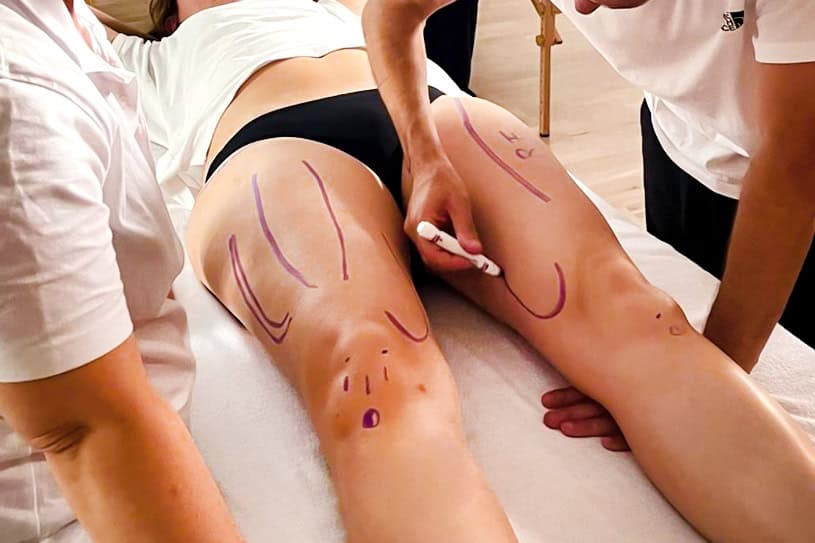 Iniezioni di fisioterapia per il miglioramento muscolare e la riabilitazione presso Evolution Academy®.