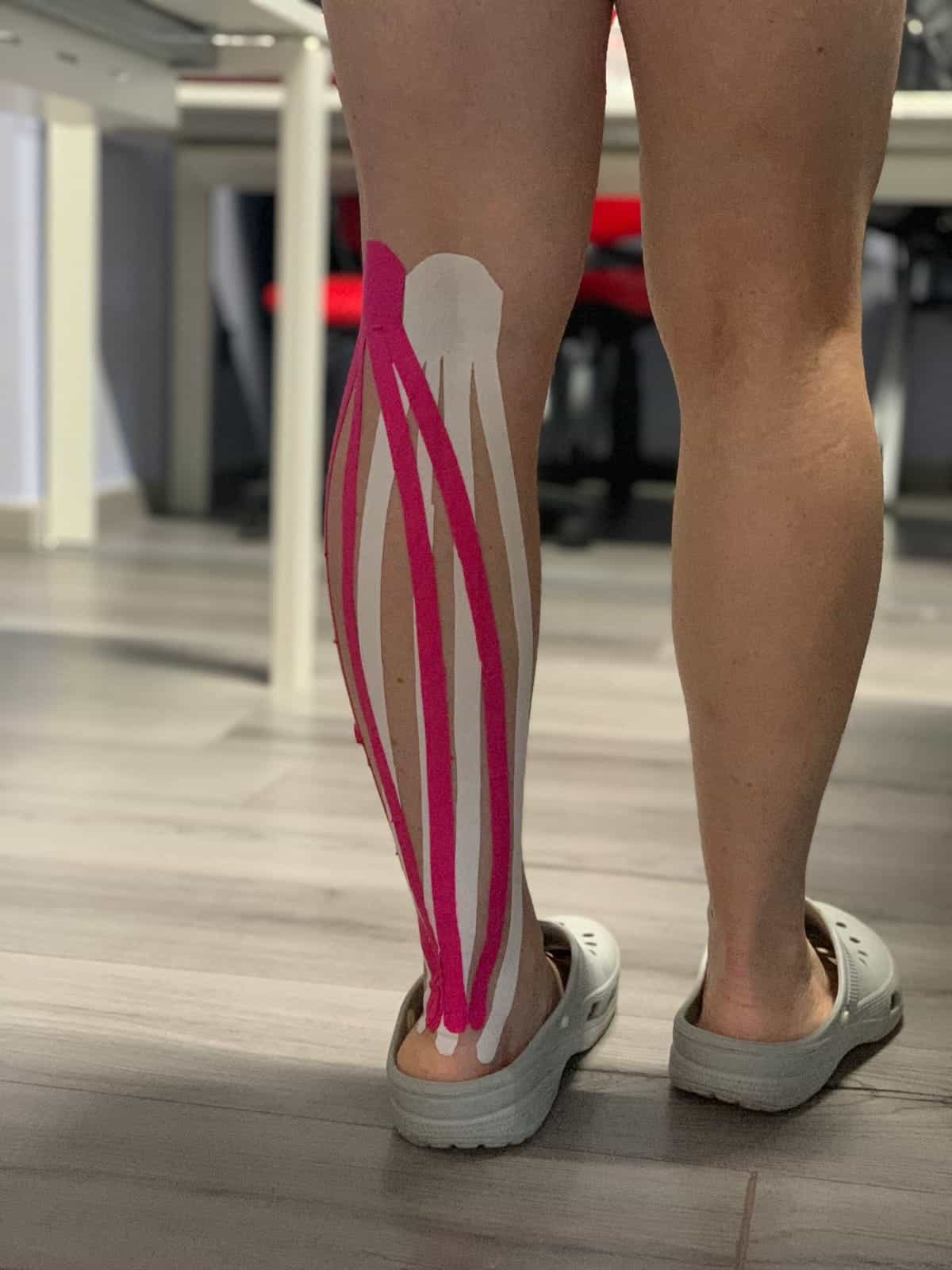 Tendine femorale illustrata con muscoli e anatomia in evidenza, utile per fisioterapia e studi di anatomia muscolare.