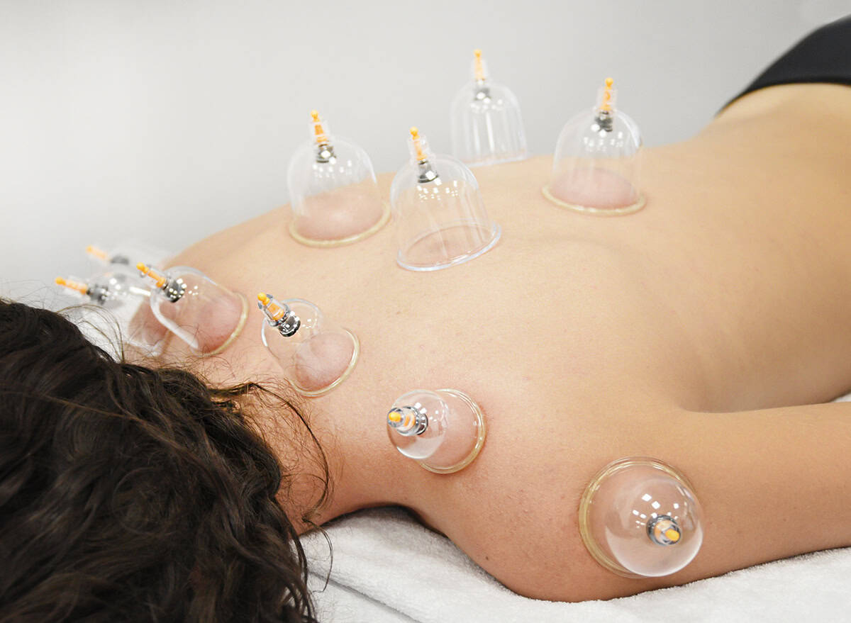 Il corso di coppettazione sportiva ed estetica a Firenze