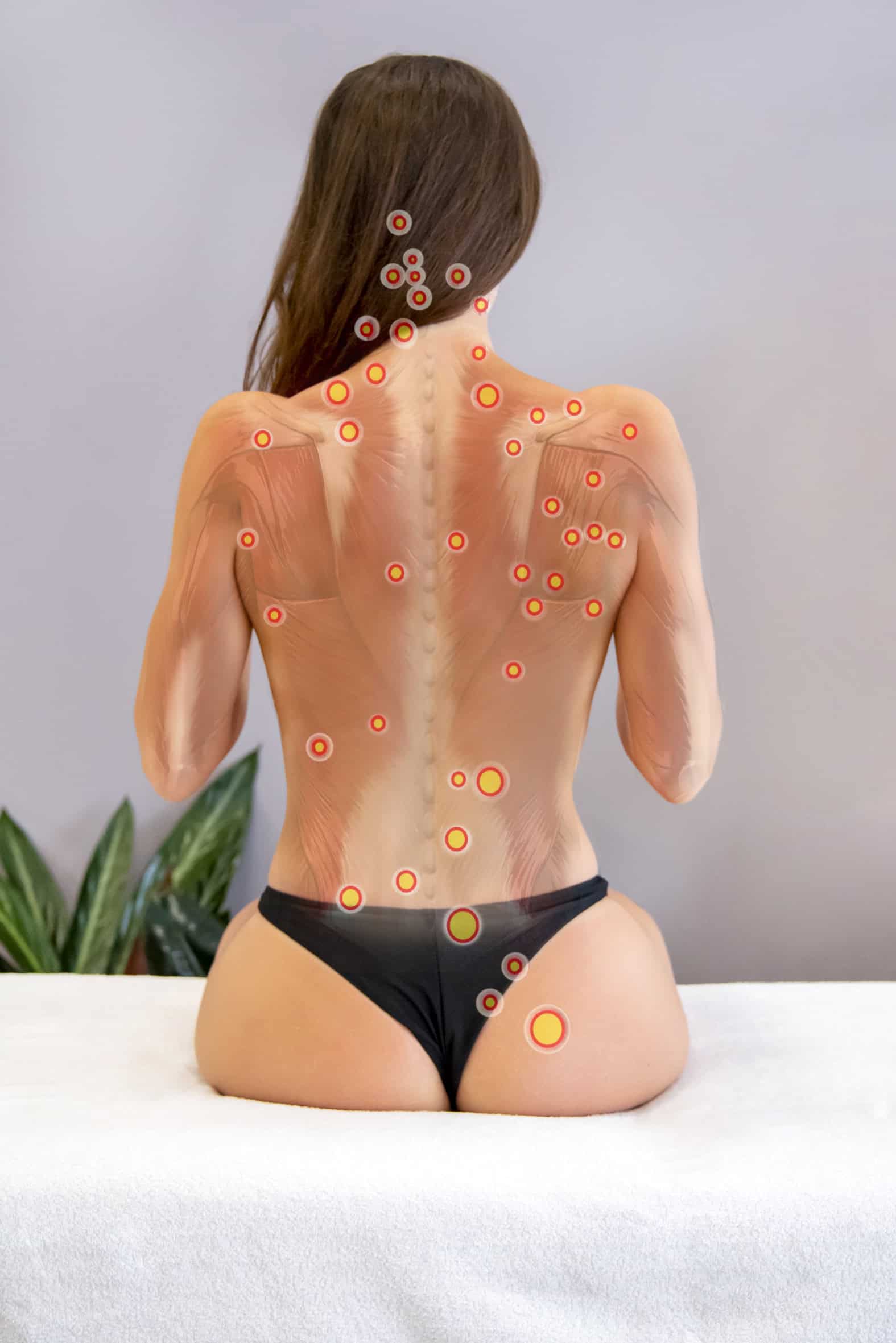 Corso Trigger Point - Scuola di Massaggio Evolution Academy