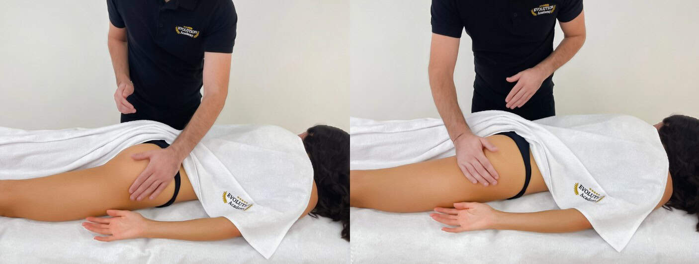 Trattamento per la sindrome del piriforme