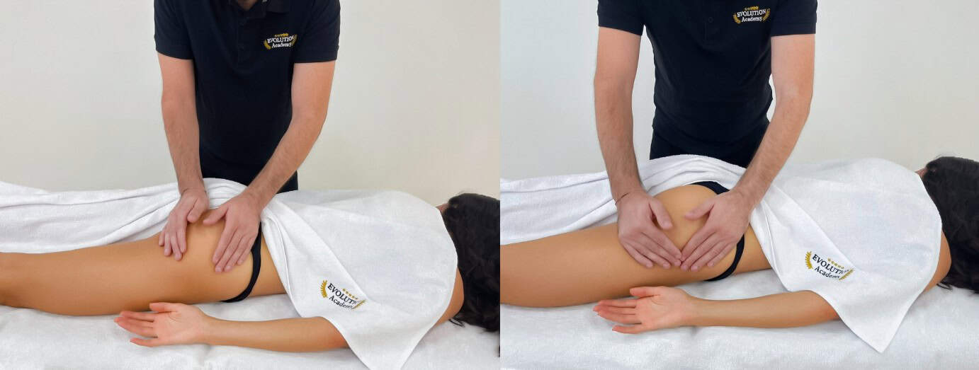 Trattamento per la sindrome del piriforme