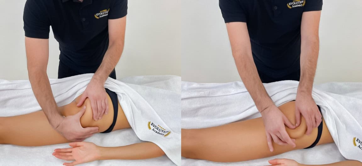 Trattamento per la sindrome del piriforme