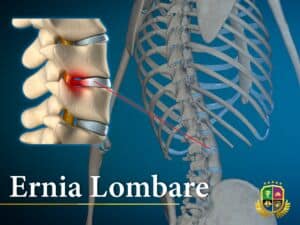Ernia lombare: la massoterapia come sollievo naturale
