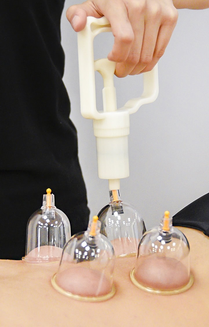 Coppettazione Sportiva ed Estetica - Scuola di Massaggio Evolution Academy