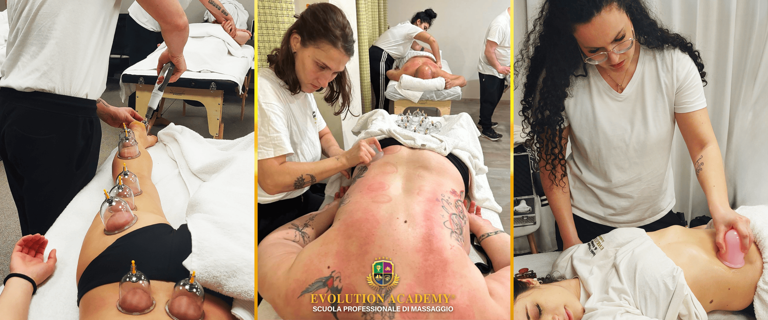 Coppettazione Sportiva ed Estetica - Scuola di Massaggio Evolution Academy